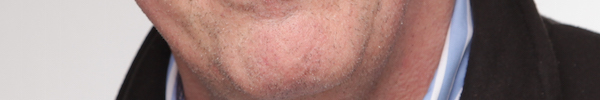 h6